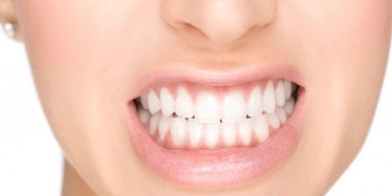 Gece uykusunda diş sıkanlar dikkat